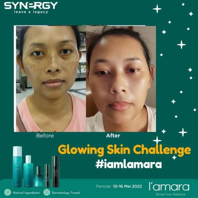 Krim Jerawat & Pemutih Wajah Cepat Ampuh Trulum Skincare Anti Aging