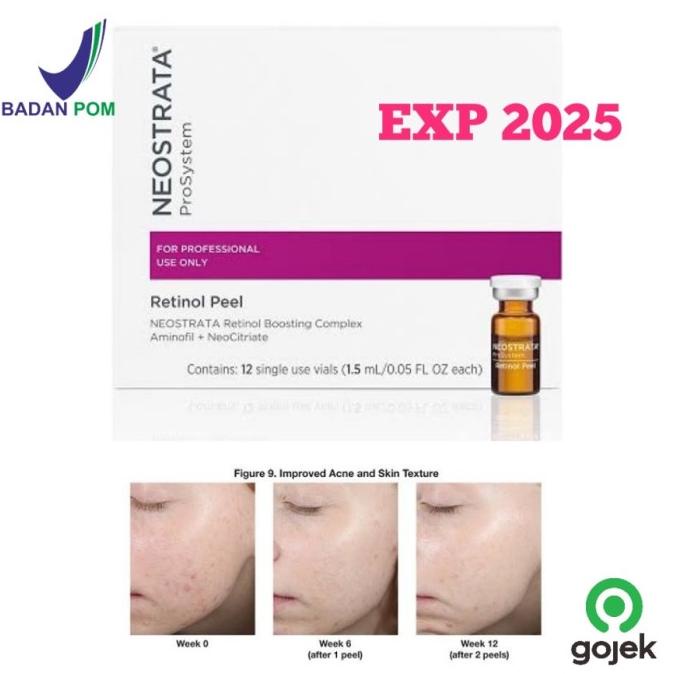 New Neostrata Prosystem Retinol Peel 3% Brightening Antiaging Peeling Usa Berkualitas