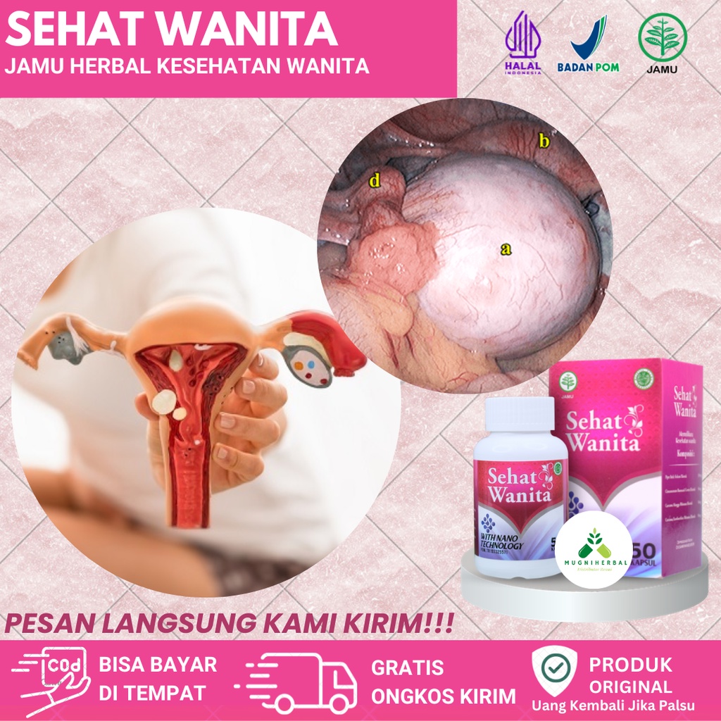 Sehat Wanita 100% Original - Obat Kista Ovarium, Kista Miom, Kista Bartholin, Kista Endometriosis, K
