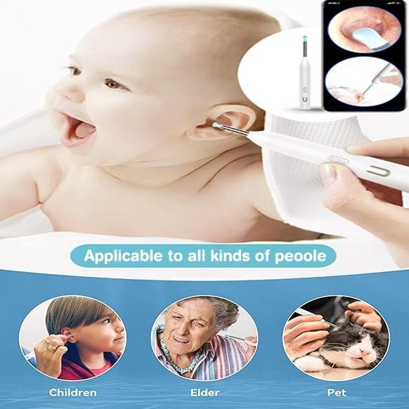 JAMAY Alat Pembersih Telinga Dengan Pemetik Telinga Visual Yang Cerda