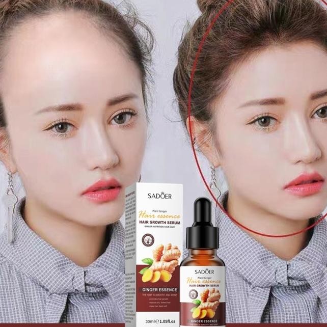 Umbuh Rambut Serum Umbuh Rambut Umbuh Rambut Botak Nyak Umbuh Rambut Hair Growth Serum Umbuh Rambut 