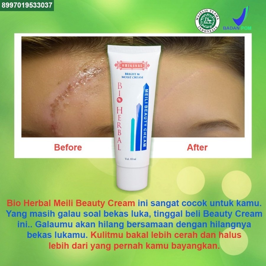 ZY6 BIO HERBAL MEILI BEAUTY CREAM - PENGHILANG LUKA - BIOHERBAL Q3I