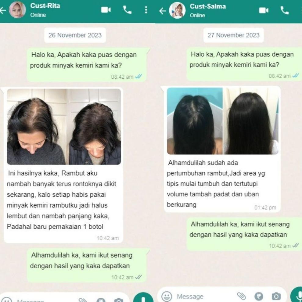New Minyak Kemiri Bakar Penumbuh Rambut Botak Obat Vitamin Penebal Rambut Rontok Original 100% Asli 