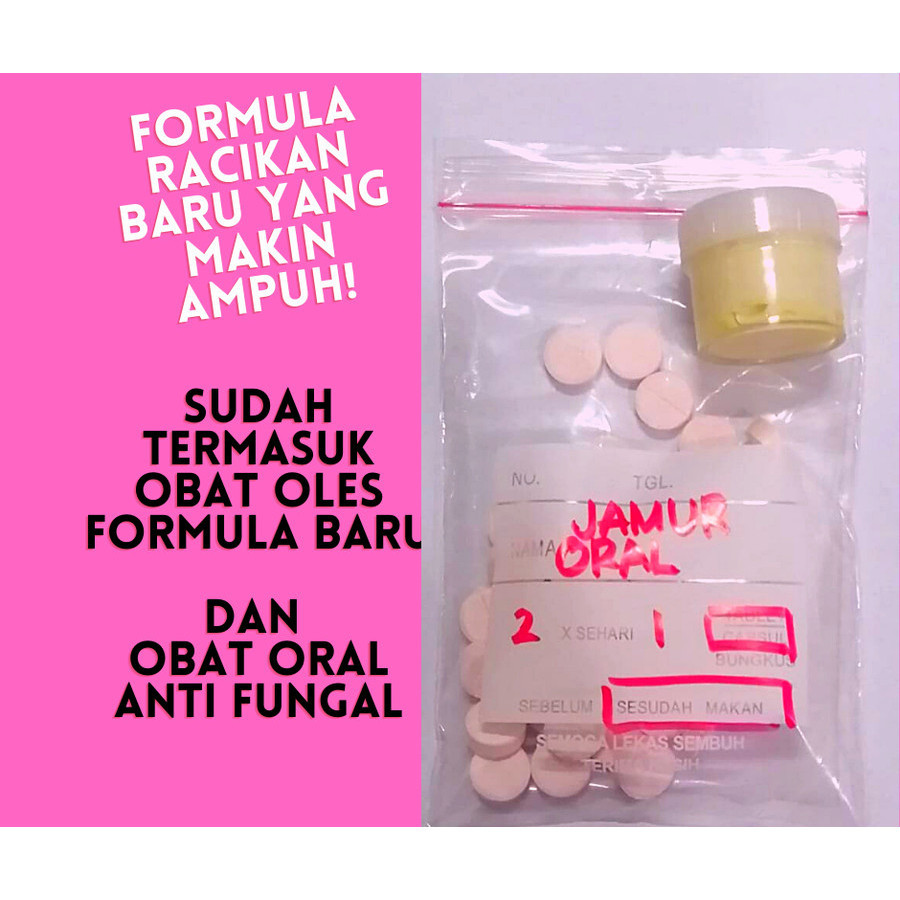 OBAT ANTI JAMUR LENGKAP (ORAL & OLES) UNTUK KUCING DEWASA & KITTEN