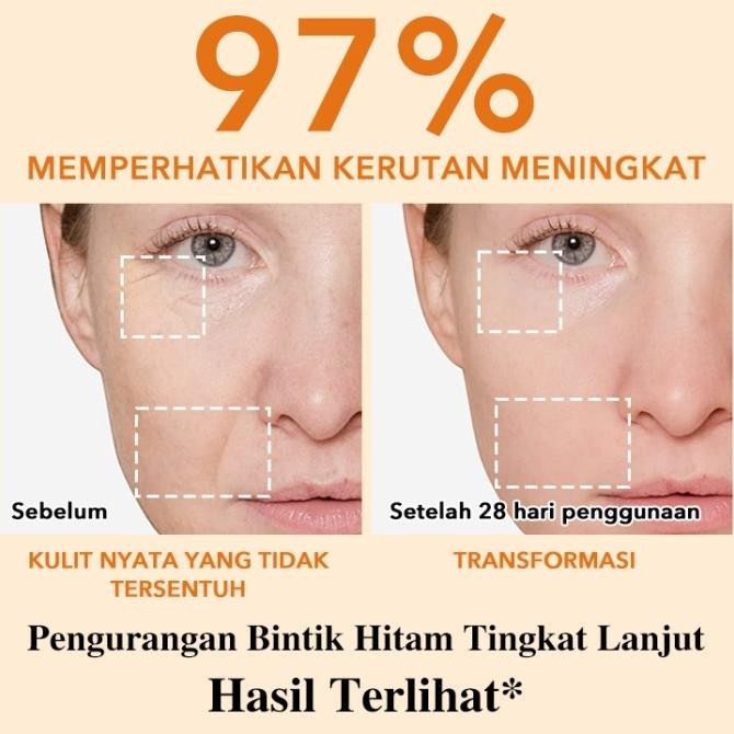 ELLEN ELLA Anti Aging Set 4X Retinol Serum 35ml + Retinol Cream 30g H24S