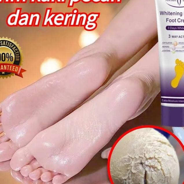 Krim Kaki Pecah Dan Kering Tutku Obat Kaki Pecah P Kaki Pecah Dan Kering Ampuh Pelembab Kaki Pecah D