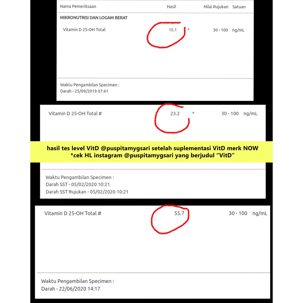NOW Vitamin D3 1000IU 2000IU 5000IU 10000IU 50000IU