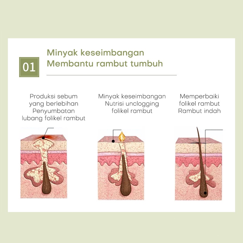 Shampo penumbuh rambut Penumbuh rambut botak Sampo penumbuh rambut cepat Shampo rambut rontok 250ml