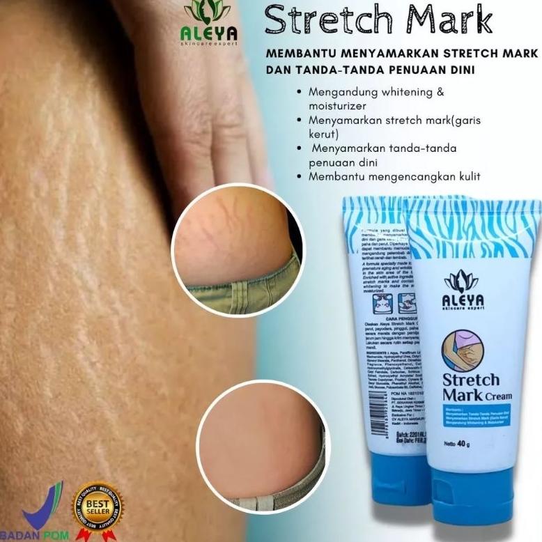 Sale Stretch Mark Cream Aleya Cream Penyamar Stretch Mark Bisa Cod