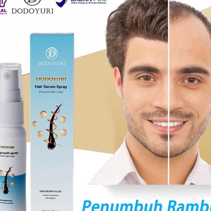 [Bpom] Umbuh Rambut Cepat Obat Umbuh Rambut Serum Umbuh Rambut Umbuh Rambut Botak 30Ml Kontrol Nyak 