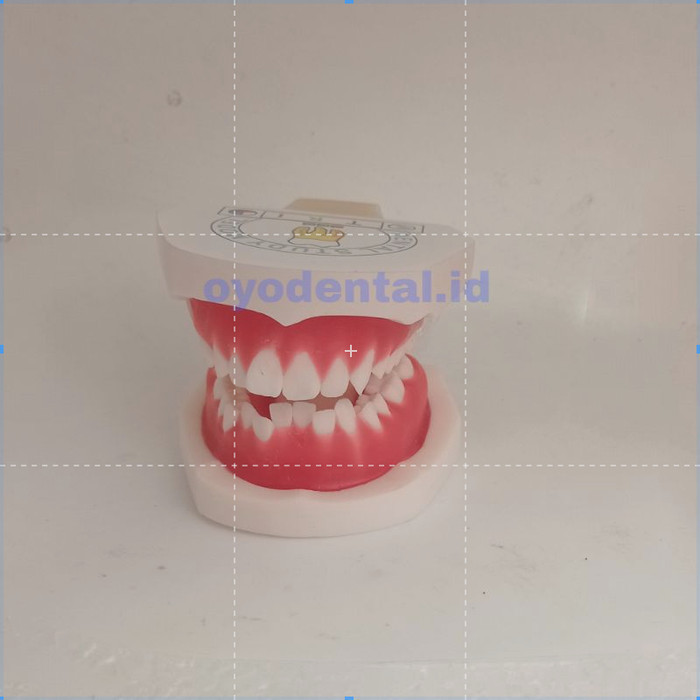 DENTAL MODEL STUDY ORTHODONTIC TYPODONT / MODEL GIGI ORTHO WAX