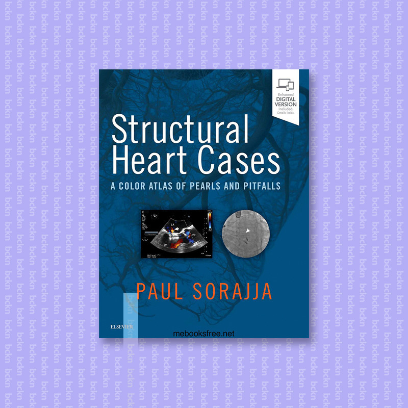 

Structural Heart Cases A Color Atlas of Pe - Paul Sorajja