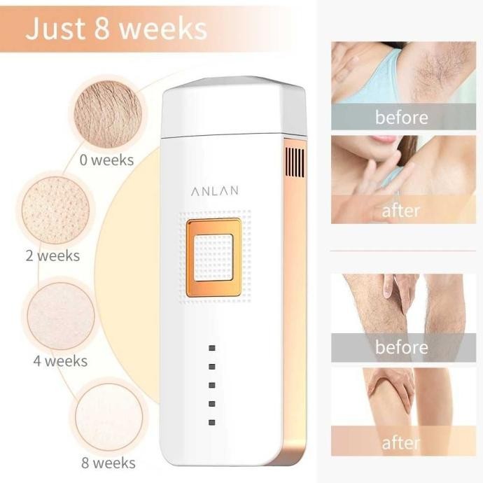 Anlan Tmy02 Ipl Laser Epilator Hair Removal 500000Flashes
