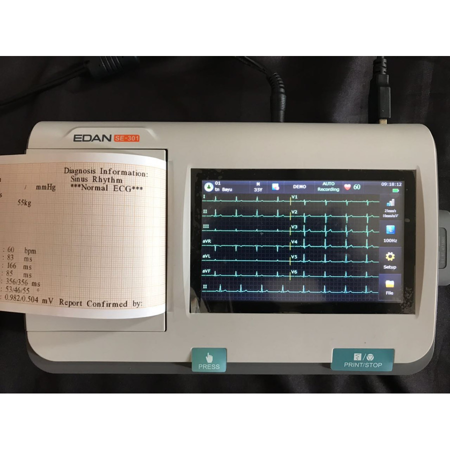 ECG EDAN SE-301 FULL TOUCH SCREEN