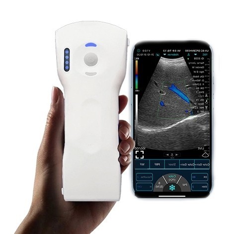 USG WIRELESS / USG POCKET / USG WIFI DUAL PROBE 2 IN 1 ULTRASOUND CONVEX PROBE DAN LINEAR PROBE ORIG