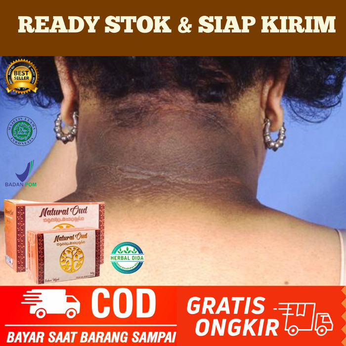 Sabun Pemutih Lipatan Leher, Sabun Memutihkan Tengkuk Leher Yang Hitam