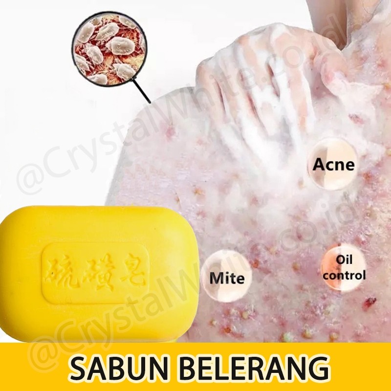 Sabun Mandi Sulfur Soap Gatal Punggung Jerawat Kulit Lembut Sabun Mandi Belerang Sabun Gatal