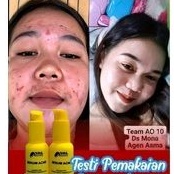 SERUM ACNE NRL KOSMETIK