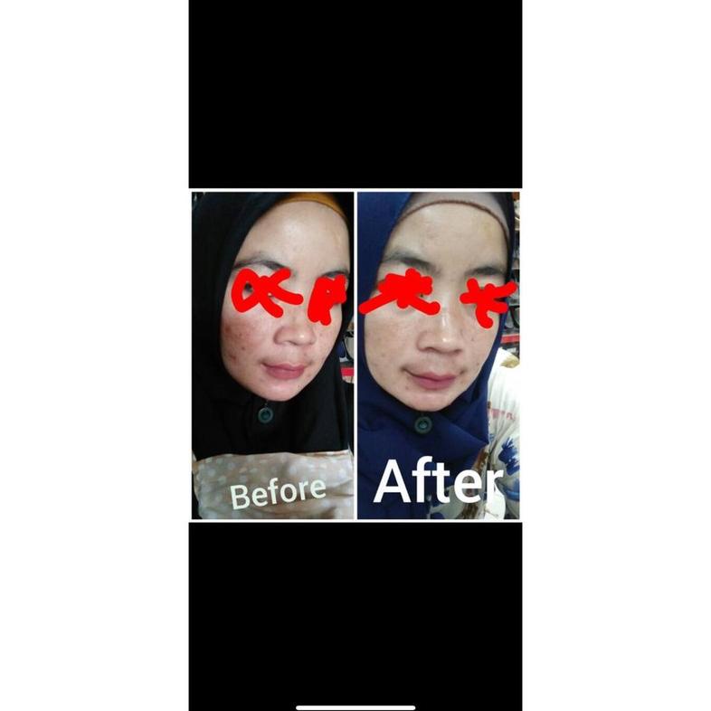 Terlaris SERUM COLLAGEN VITAMIN C BPOM WAJAH GLOWING PEMUTIH KOREA ORI KRIM FARMA CREAM DOKTER SKINC