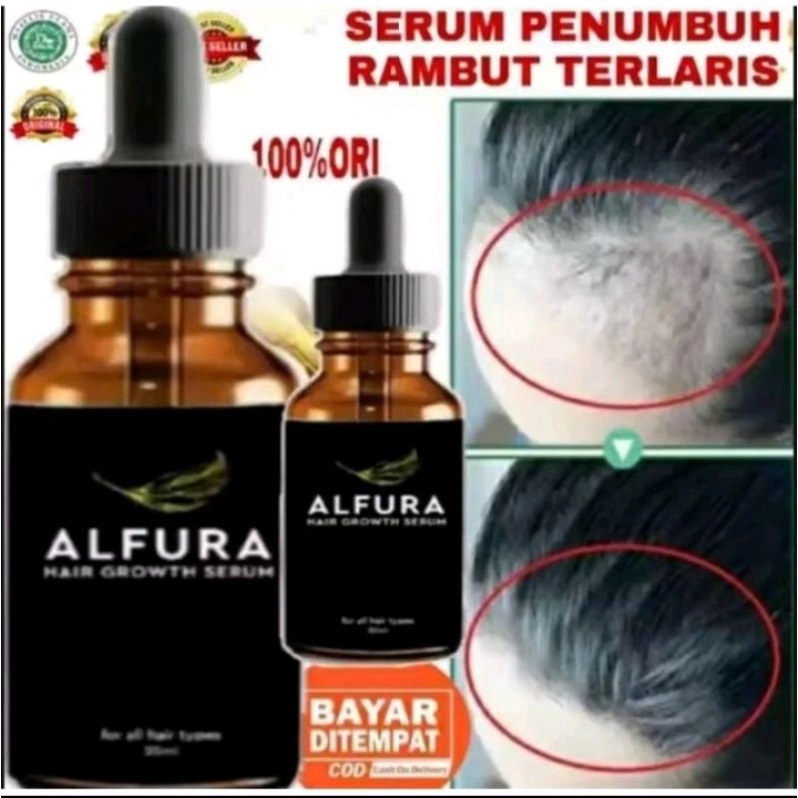 PENUMBUH RAMBUT SECARA CEPAT ALFURA ORIGINAL PRIA/WANITA - Penumbuh Rambut Secara Cepat / Obat Penum