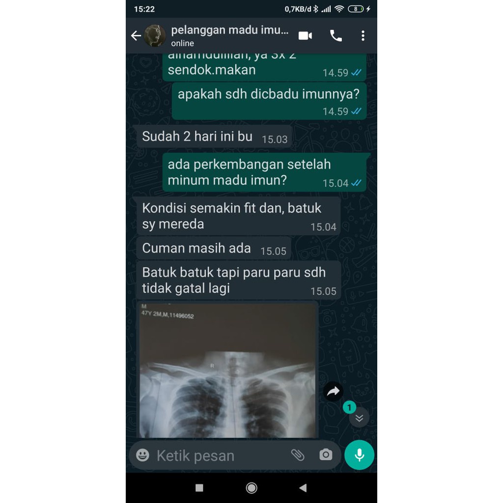 

Juni Madu Hutan Imun Angkal Virus , Madu Untuk Ambah Imunitas Tubuh Ampuh