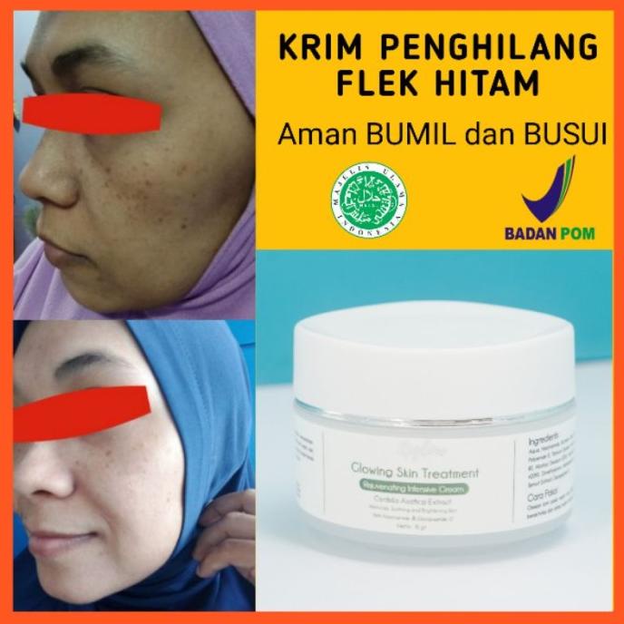 KRIM REGLOW UNTUK PENGHILANG FLEK HITAM SKINCARE ORIGINAL BUMIL