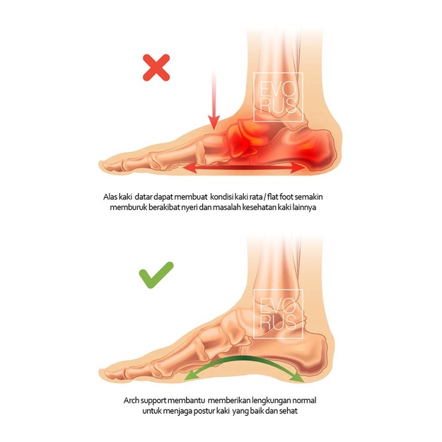 Scholl Pnc7 Leather Sandal 100% Original - Sandal Wanita Kulit Asli