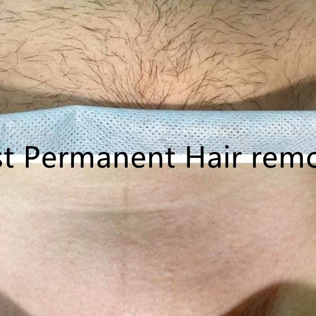 Hair Removal Spray Perontok Bulu Permanen Cukuran Bulu Kemaluan Untuk Kaki Tangan Dan Ketiak Non-Irr