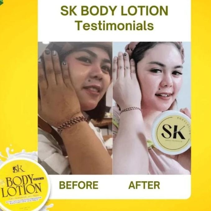 Sk Body Lotion Extra Whitening | Anzora Exfoliating Cream Treatment