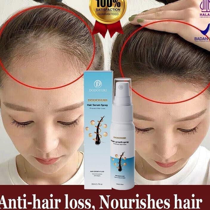 [Bpom] Umbuh Rambut Cepat Obat Umbuh Rambut Serum Umbuh Rambut Umbuh Rambut Botak 30Ml Kontrol Nyak 