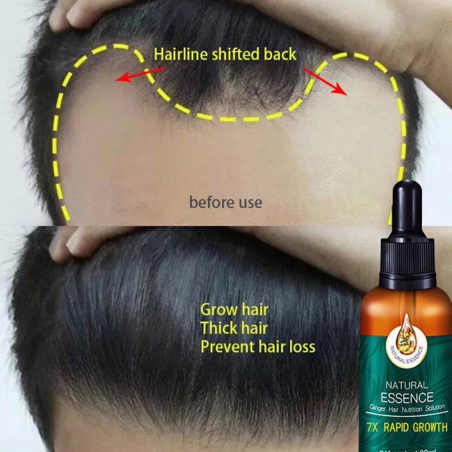 Ebal RambutObat Umbuh RambutAnti Rambut RontokMemperbaiki Tekstur RambutSerum Umbuh RambutVitan Memp