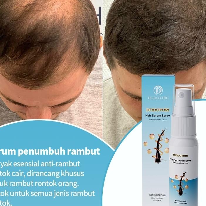 [Bpom] Dodoyuri Serum Umbuh Rambut Umbuh Rambut Botak Obat Umbuh Rambut 30Ml Umbuh Rambut Cepat Kont