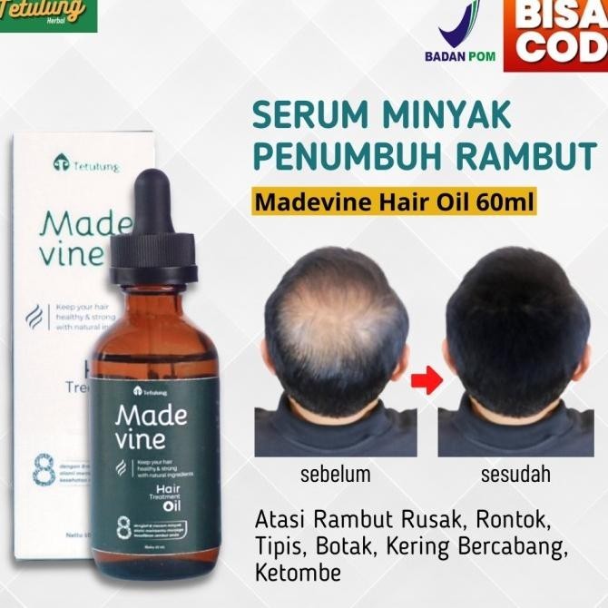 [Best Seller] Serum Penumbuh Rambut Botak Rontok Madevine