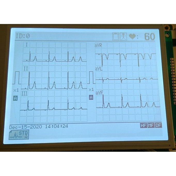 Lcd Untuk Ekg Fukuda Denshi