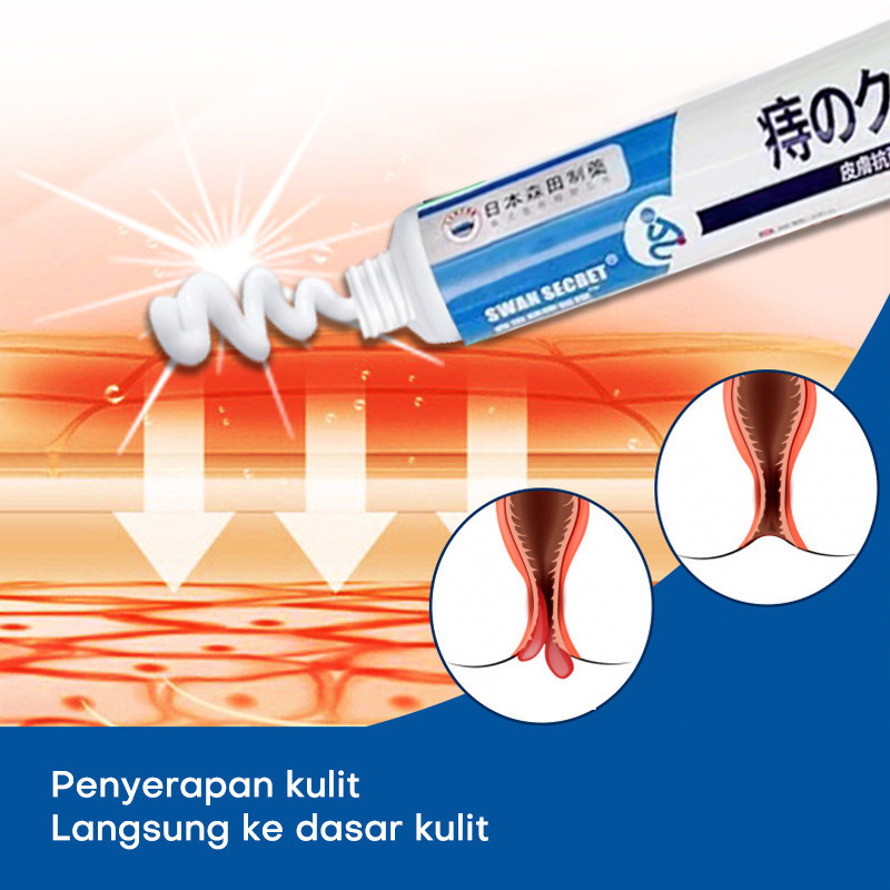 [READY] Obat wasir obat ambeien paling ampuh salep wasir 20g Salep wasir ampuh asli cina Krim Wasir