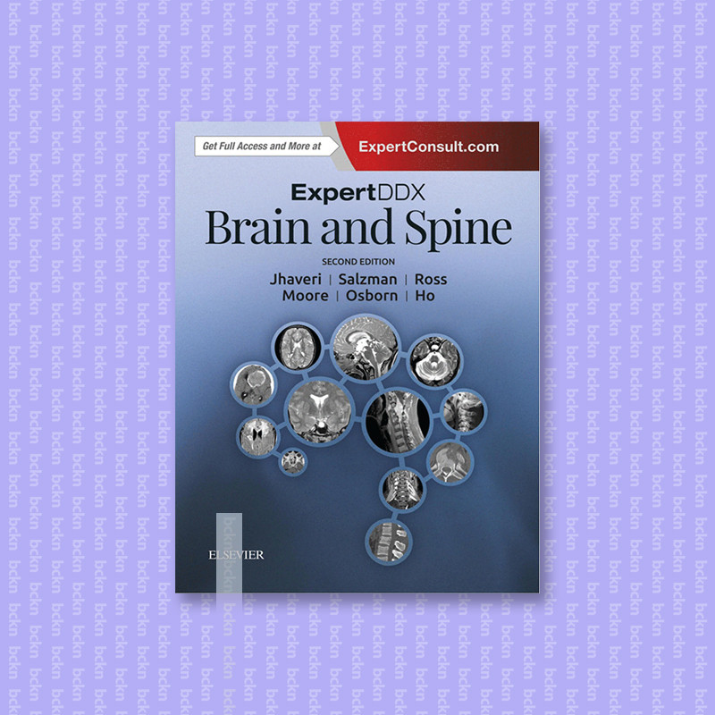 

ExpertDDx Brain and spine - Miral D. Jhaveri