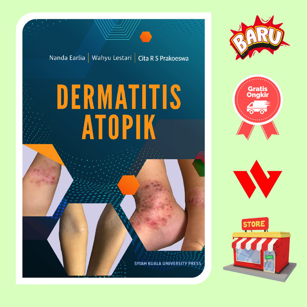 Buku Dermatitis Atopik - Nanda Earlia