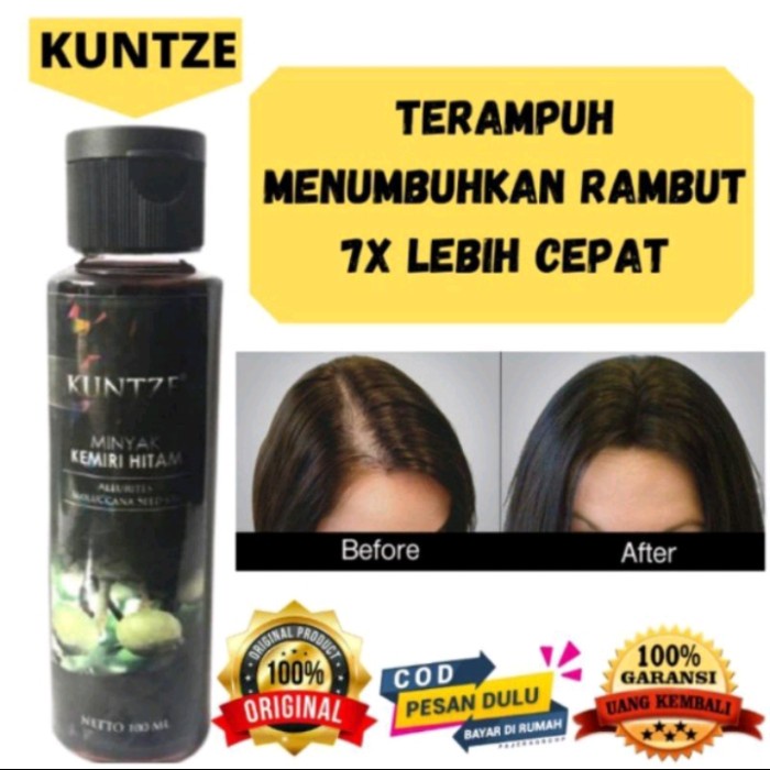 MINYAK KEMIRI KUNTZE ORIGINAL BPOM