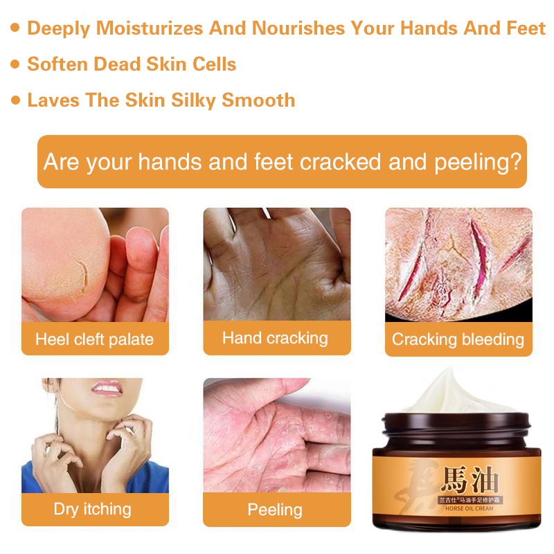 Krim Kaki Tangan Krim Kaki Pecah Pecah Pemutih Tangan Dan Kaki Nyak Kuda Tangan Dan Kaki Retak Tut