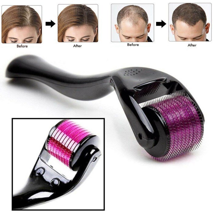 Promo Alat Roller Skin - Penumbuh Rambut Dermaroller Treatment Rambut Botak