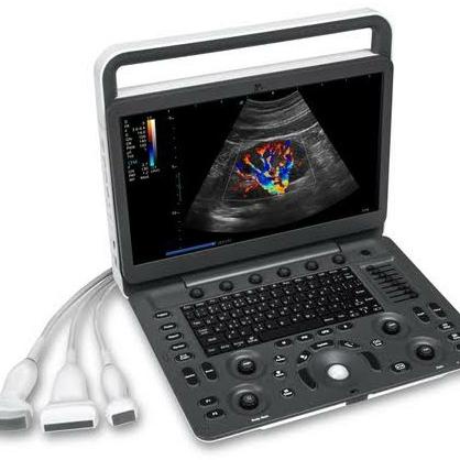 Terlaris USG Echo Ultrasound 2D Sonoscape E2 Cardiac SALE
