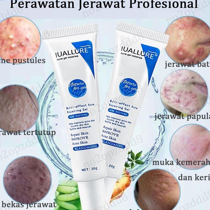 Iuallure Ghilang Jerawat 20G Jerawat Parah Meradang Bog Krim White Salicylic Acid Treatment Gel Anti