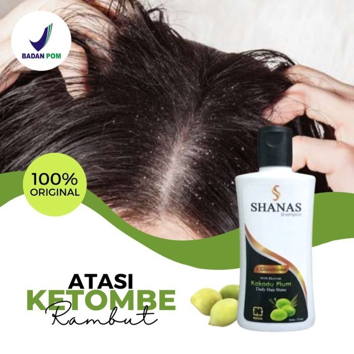 Terbaru Shampo Penghilang Kutu / Shanas Shampoo Kutu / Sampo Shanas Nasa Promo Terlaris