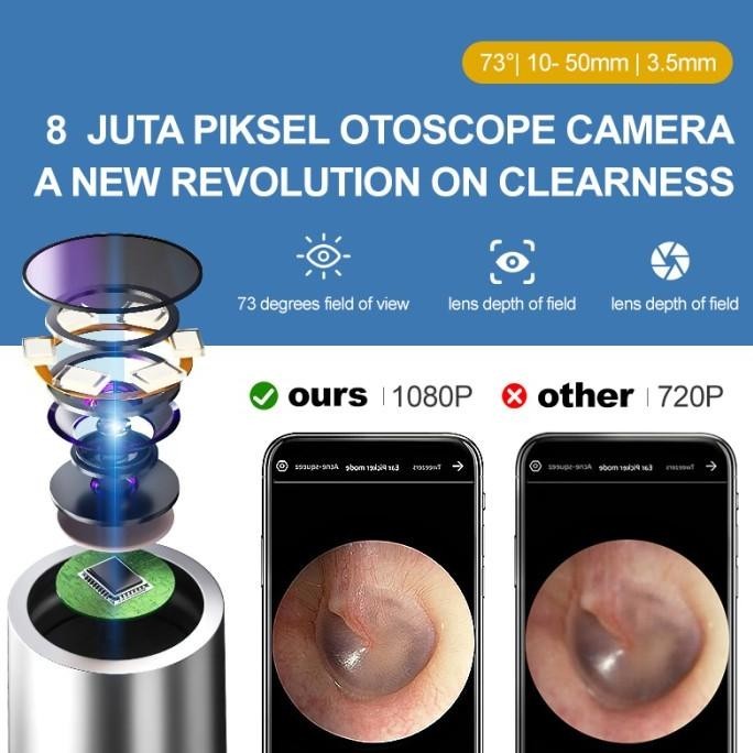 Alat pembersih telinga dengan pemetik telinga visual yang cerdas