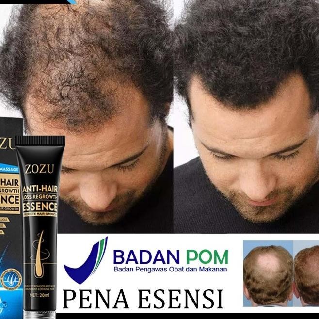 [Obat Umbuh Rambut Botak Pria] Serum Umbuh Rambut Obat Umbuh Rambut Rambut Rontok Dan Umbuh Rambut 2