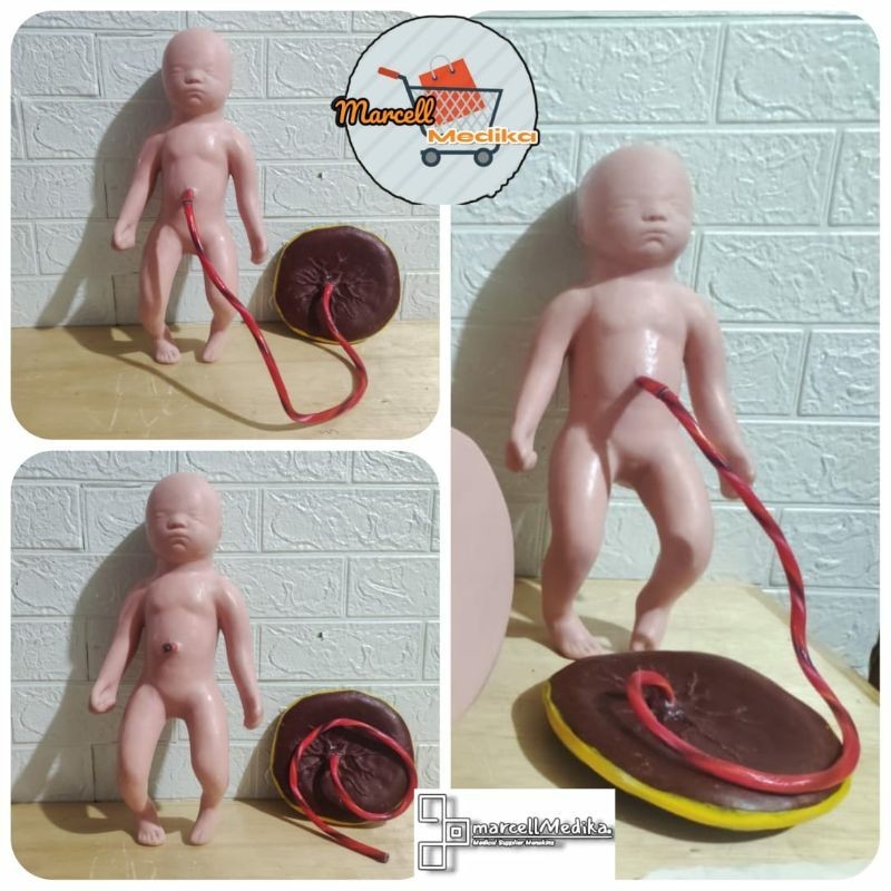 PHANTOM MANEKIN BAYI PLASENTA SILICONE / MANIKIN BAYI PLASENTA SILIKON