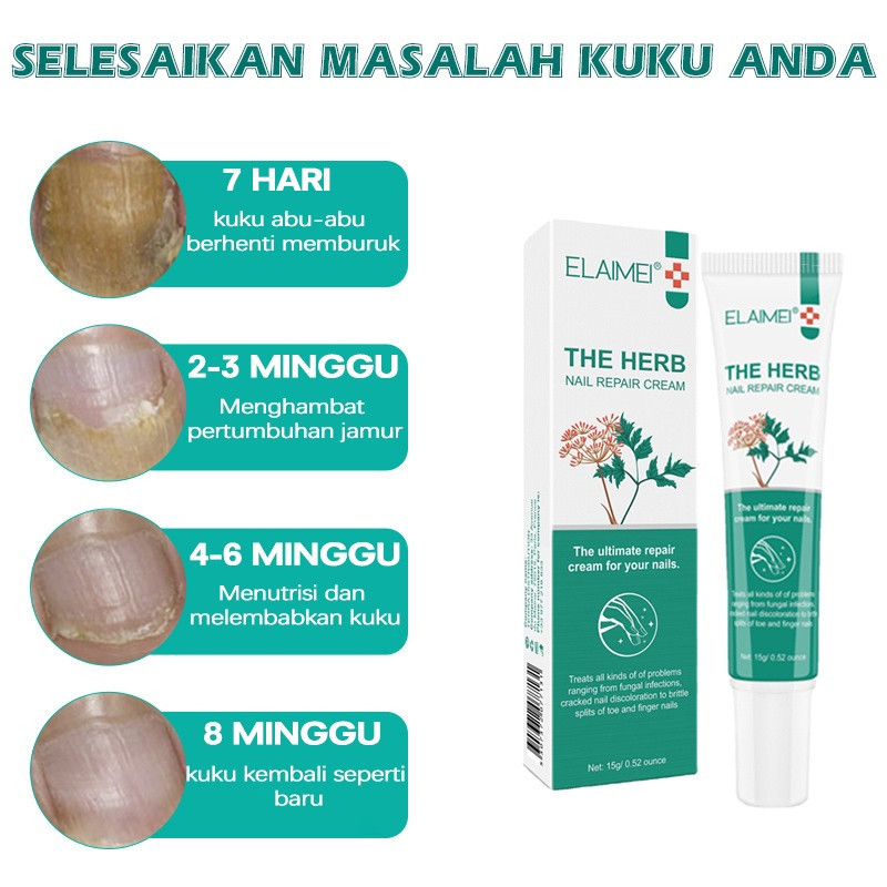 [READY] Cairan Obat Infeksi Kuku Anti Jamur Perawatan Kuku Rusak Repair obat kuku jamur dan rusak