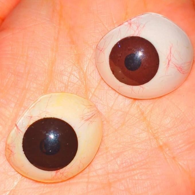 Mata Palsu Buatan Artificial