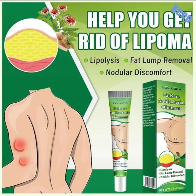 SOL LORA FATKARE ANTIBACTERIAL OINTMENT SPESIAL LIPOMA CREAM Termurah