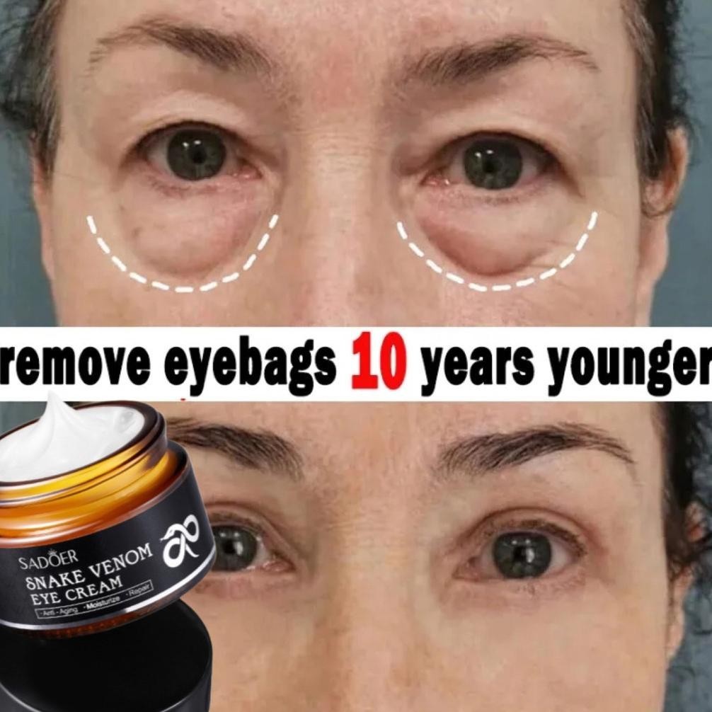 SADOER EYE CREAM/MENGHILANGKAN MATA PANDA/PENGHILANG KANTUNG MATA/EYE CREAM MATA PANDA/SERUM MATA PA